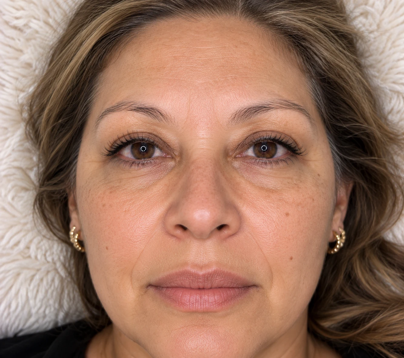 Labios antes del lip blush