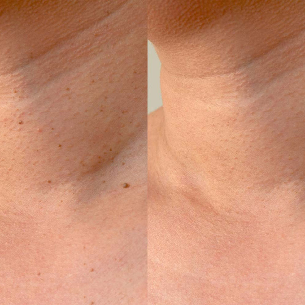 Skin Appearance Services result - S001