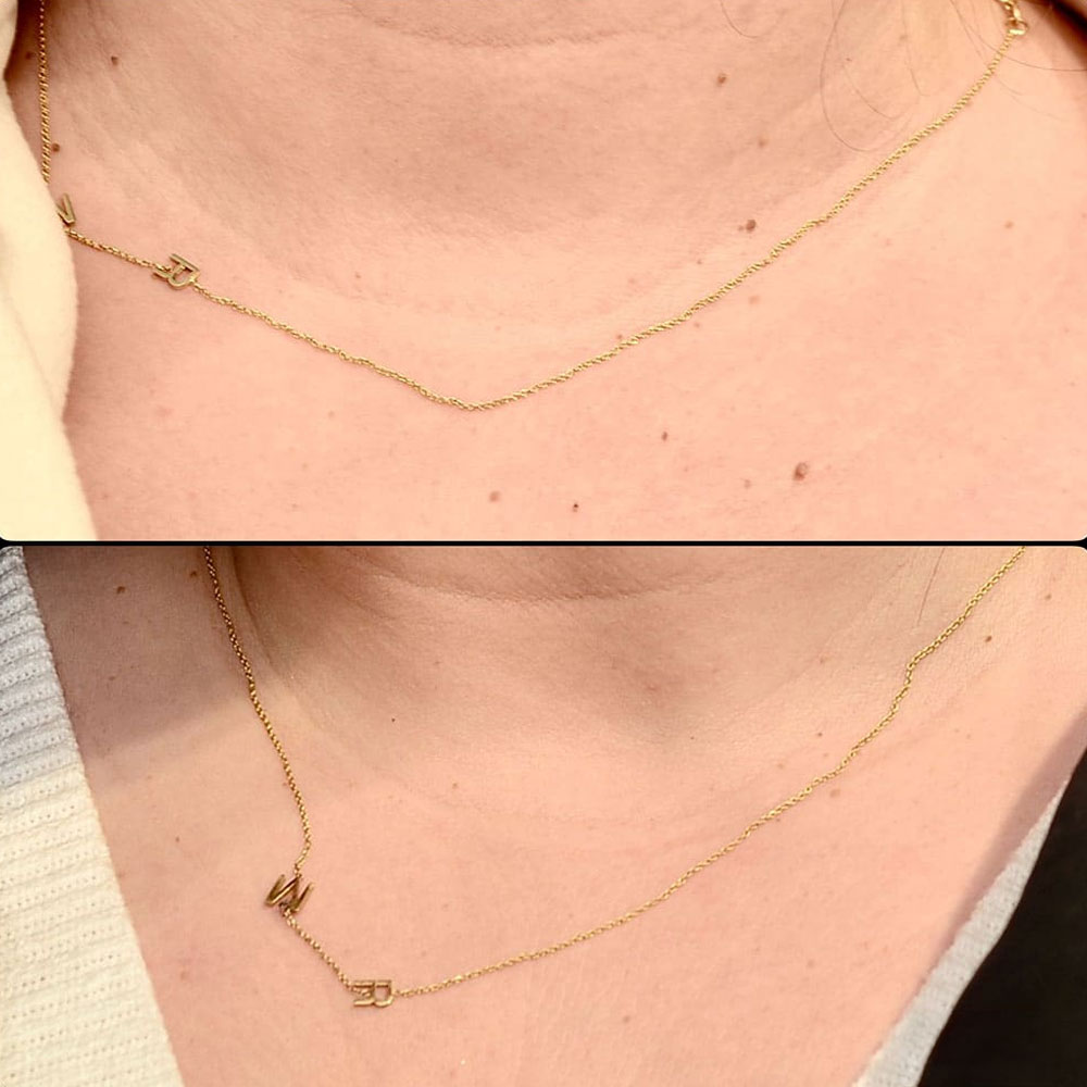 Skin Appearance Services result - S002